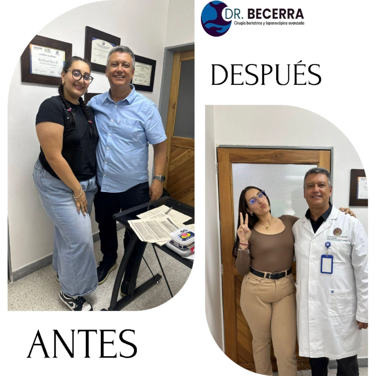 Antes y Después 1