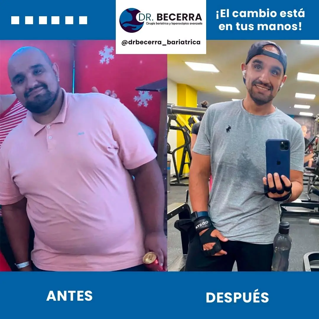 Antes y Después 2