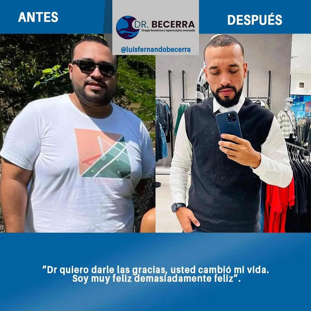 Antes y Después 3