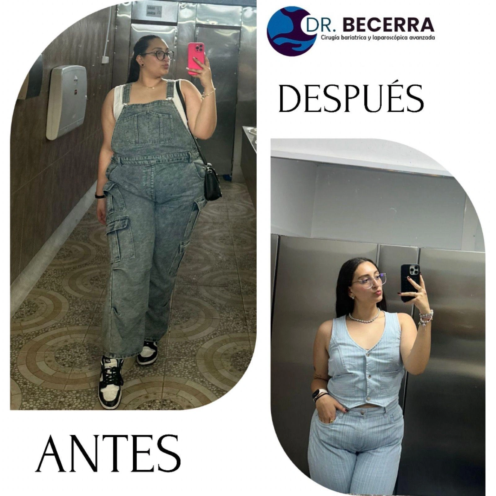 Antes y Después 4