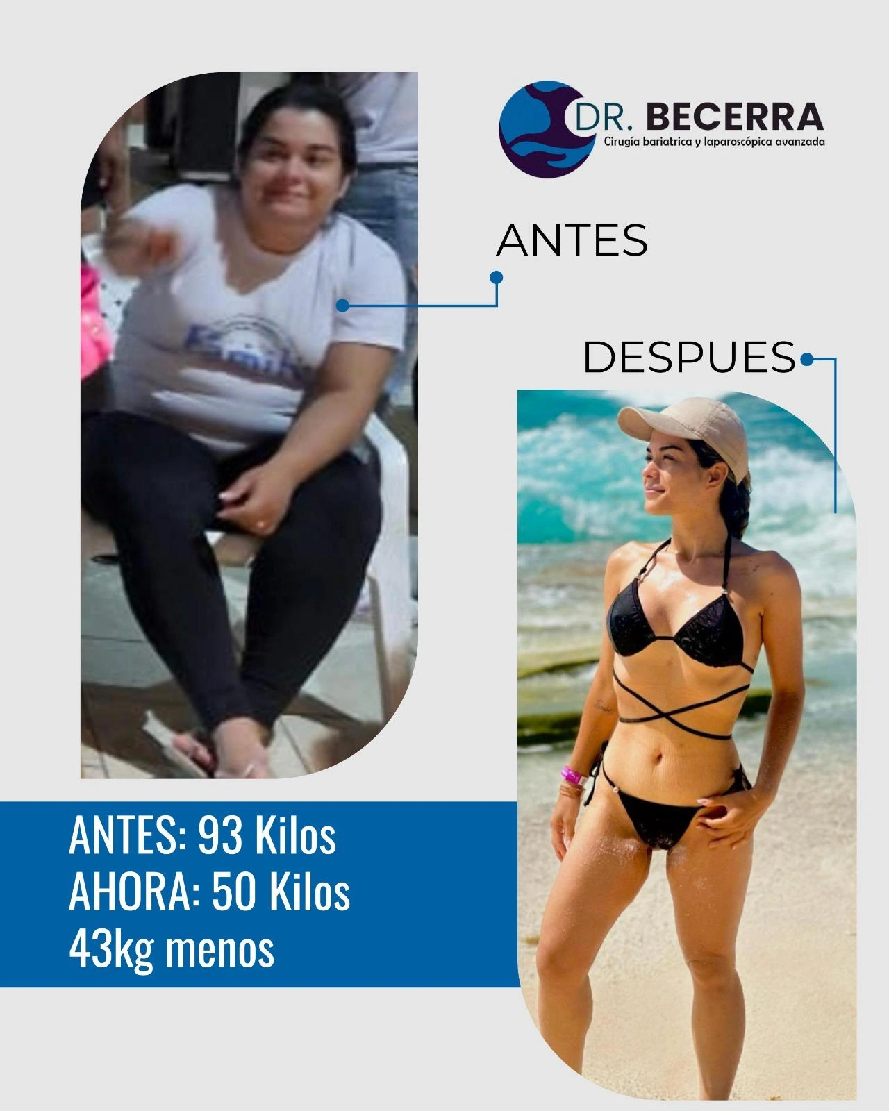 Antes y Después 6